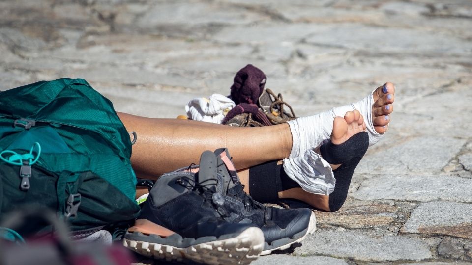 una pellegrina con i piedi fasciati